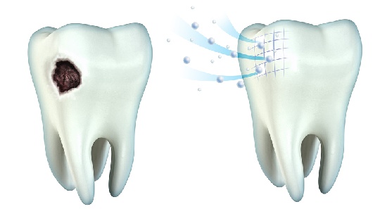 Rimineralizzazione del Dente