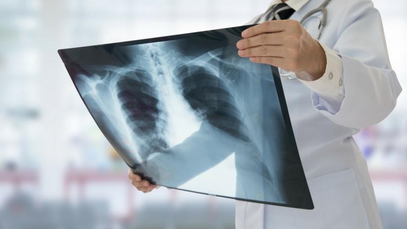 Radiografia: che cos'è e in che cosa consiste - Paginemediche