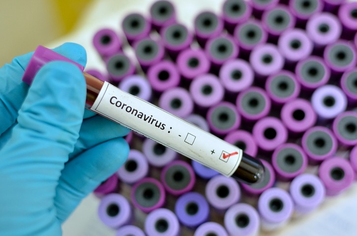 Coronavirus, altri 23 decessi in Piemonte. Ma sono oltre 400 i ...